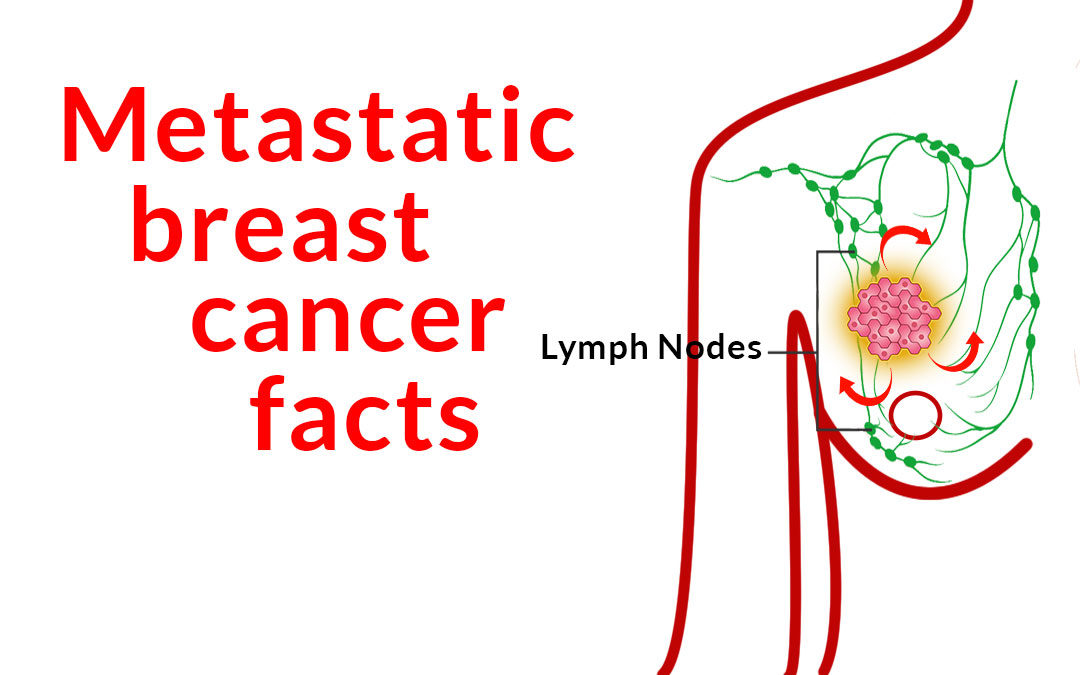 How to control metastatic breast cancer